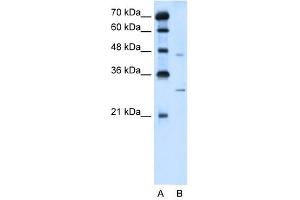 SLC36A3 antibody used at 5 ug/ml to detect target protein. (SLC36A3 Antikörper)