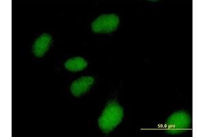 Immunofluorescence of purified MaxPab antibody to NUBP1 on HeLa cell.