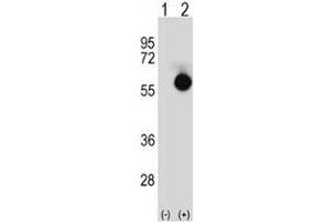 Western blot analysis of CTBP2 antibody and 293 cell lysate either nontransfected (Lane 1) or transiently transfected (2) with the CTBP2 gene. (CTBP2 Antikörper  (AA 1-30))