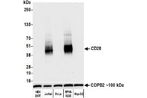 Western Blotting (WB) image for anti-CD28 (CD28) (AA 170-220) antibody (ABIN7455122) (Rekombinanter CD28 Antikörper  (AA 170-220))