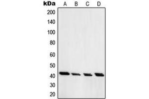 Western blot analysis of PRKAR1A expression in Jurkat (A), HT29 (B), H1299 (C), A549 (D) whole cell lysates. (PRKAR1A Antikörper  (C-Term))