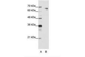 Image no. 2 for anti-Splicing Factor 1 (SF1) (N-Term) antibody (ABIN203234) (Splicing Factor 1 Antikörper  (N-Term))