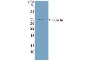 Detection of Recombinant calretinin, Human using Polyclonal Antibody to Calretinin (CR) (Calretinin Antikörper  (AA 28-248))