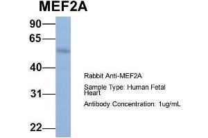 Host: Rabbit Target Name: MEF2A Sample Type: Human Fetal Heart Antibody Dilution: 1. (MEF2A Antikörper  (N-Term))
