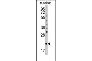 Image no. 1 for anti-BH3 Interacting Domain Death Agonist (BID) (pSer61) antibody (ABIN356817) (BID Antikörper  (pSer61))