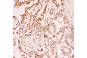 anti-Sirtuin 2 (SIRT2) (AA 165-187), (Middle Region) antibody