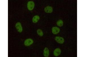 Immunocytochemistry stain of Hela using DNA-PKcs mouse mAb (1:100). (PRKDC Antikörper)