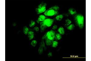 Immunofluorescence of monoclonal antibody to IRF5 on A-431 cell. (IRF5 Antikörper  (AA 395-504))