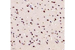 Immunohistochemistry (Paraffin-embedded Sections) (IHC (p)) image for anti-tRNA-YW Synthesizing Protein 1 Homolog B (S. Cerevisiae) (TYW1B) antibody (ABIN7076025)