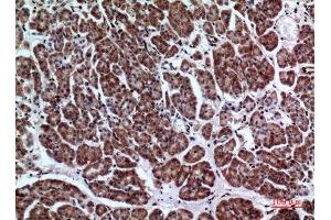 Immunohistochemistry (IHC) image for anti-Leukocyte Immunoglobulin-Like Receptor, Subfamily A (With TM Domain), Member 2 (LILRA2) (Internal Region) antibody (ABIN6281107)