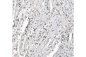 IHC analysis of FOXK1 using anti-FOXK1 antibody (ABIN7600295). (Foxk1 Antikörper  (AA 175-671))
