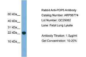 WB Suggested Anti-POP5  Antibody Titration: 0. (POP5 Antikörper  (Middle Region))
