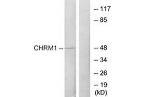 Western blot analysis of extracts from HepG2 cells, using CHRM1 Antibody. (CHRM1 Antikörper  (AA 295-344))