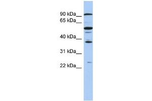 WB Suggested Anti-EZH1 Antibody Titration:  0. (EZH1 Antikörper  (N-Term))