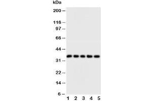 Western blot testing of FosB antibody and Lane 1:  HT1080;  2: SW620;  3: HeLa;  4: SMMC-7721;  5: MM453 cell lysate (FOSB Antikörper  (N-Term))