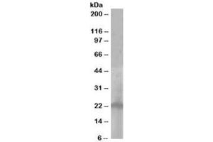 Western blot testing of A431 lysate with PALLID antibody at 1ug/ml. (Pallidin Antikörper)