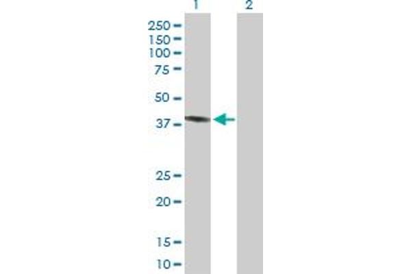 PECI/ECI2 Antikörper  (AA 1-364)