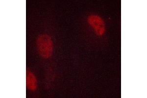 ABIN6267039 staining MCF-7 cells by ICC/IF. (Histone 3 Antikörper)