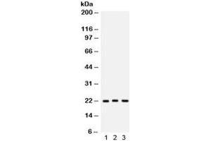 Western blot testing of 1) human A549, 2) rat brain and 3) mouse brain lysate with Peroxiredoxin 5 antibody. (Peroxiredoxin 5 Antikörper  (AA 66-198))