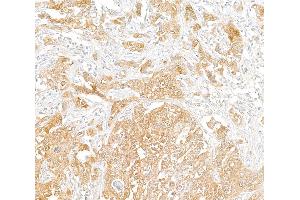 Immunohistochemistry (IHC) image for anti-phosphoglycerate Dehydrogenase (PHGDH) (AA 1-50) antibody (ABIN7455052) (PHGDH Antikörper  (AA 1-50))