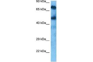 Host:  Rabbit  Target Name:  KCND3  Sample Tissue:  Liver Tumor lysates  Antibody Dilution:  1ug/ml (KCND3 Antikörper  (C-Term))