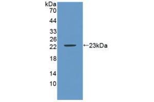 Western blot analysis of recombinant Mouse CA9. (CA9 Antikörper  (AA 88-280))