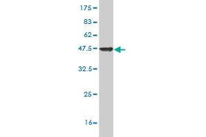 Western Blot detection against Immunogen (42. (SAP18 Antikörper  (AA 1-153))