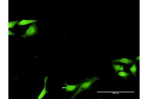 Immunofluorescence of purified MaxPab antibody to SNF8 on HeLa cell. (SNF8 Antikörper  (AA 1-258))