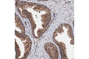 Immunohistochemical staining of human prostate with KIAA0256 polyclonal antibody  shows strong cytoplasmic positivity in glandular cells.