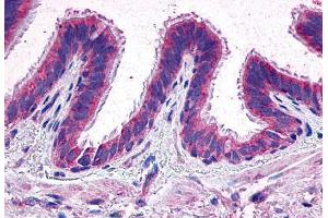 Anti-EP2 antibody  ABIN1048569 IHC staining of human lung.