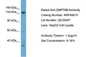 WB Suggested Anti-GNPTAB  Antibody Titration: 0.