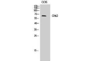 Western Blotting (WB) image for anti-Checkpoint Kinase 2 (CHEK2) (Tyr599) antibody (ABIN3183906) (CHEK2 Antikörper  (Tyr599))