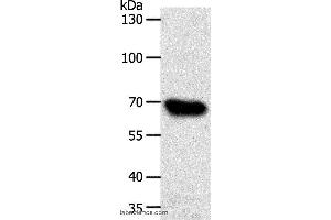 Western blot analysis of HT-29 cell, using ABCG1 Polyclonal Antibody at dilution of 1:500