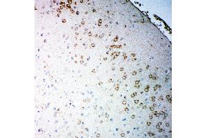 Anti-Muscarinic Acetylcholine Receptor 2 antibody,  IHC(P) IHC(P): Rat Brain Tissue (Muscarinic Acetylcholine Receptor M2 Antikörper  (C-Term))