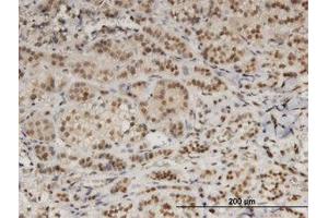 Image no. 1 for anti-Damage Specific DNA Binding Protein 1 (DDB1) (AA 1044-1141) antibody (ABIN599367) (DDB1 Antikörper  (AA 1044-1141))