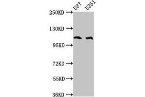 Western Blot Positive WB detected in: U87 whole cell lysate, U251 whole cell lysate All lanes: ABL2 antibody at 4 μg/mL Secondary Goat polyclonal to rabbit IgG at 1/50000 dilution Predicted band size: 129, 125, 127, 115, 118, 116, 117, 61 kDa Observed band size: 115 kDa (ABL2 Antikörper  (AA 862-1064))