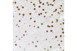 Immunohistochemistry of paraffin-embedded mouse brain using FAF1 antibody (ABIN5975642) (40x lens). (FAF1 Antikörper)