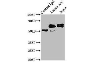 Immunoprecipitating Lamin A/C in Hela whole cell lysate Lane 1: Rabbit control IgG instead of ABIN7127601 in Hela whole cell lysate. (Rekombinanter Lamin A/C Antikörper)