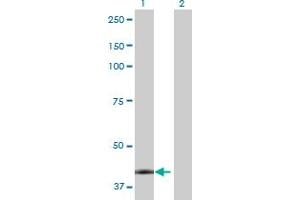 Western Blotting (WB) image for CA12 293T Cell Transient Overexpression Lysate(Denatured) (ABIN1331141)