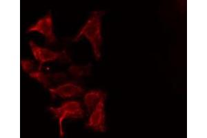 ABIN6275868 staining HuvEc cells by IF/ICC. (CD90 Antikörper  (Internal Region))