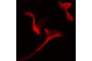 ABIN6274785 staining A549 cells by IF/ICC. (PGD Antikörper  (C-Term))
