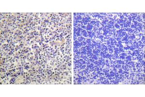 Peptide - +Immunohistochemistry analysis of paraffin-embedded human thyroid gland tissue using HBP1 antibody. (HBP1 Antikörper)