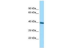 Western Blotting (WB) image for anti-Transmembrane Protein 30A (TMEM30A) (Middle Region) antibody (ABIN2782953)