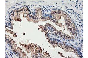 Immunohistochemical staining of paraffin-embedded Human prostate tissue using anti-ACSS2 mouse monoclonal antibody. (ACSS2 Antikörper)