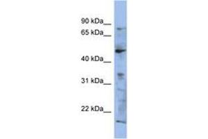 Image no. 1 for anti-RAB3A Interacting Protein (Rabin3) (RAB3IP) (AA 107-156) antibody (ABIN6743739) (RAB3IP Antikörper  (AA 107-156))