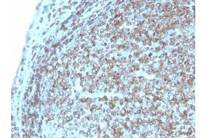 Formalin-fixed, paraffin-embedded human Tonsil stained with CD74 Recombinant Rabbit Monoclonal Antibody (CLIP/3127R). (Rekombinanter CD74 Antikörper)