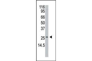 Western blot analysis of anti-H1 Antibody (N-term) 6302a in  cell line lysates (35 μg/lane). (APH1A Antikörper  (N-Term))