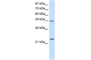 WB Suggested Anti-CBX6 Antibody Titration:  2. (CBX6 Antikörper  (N-Term))