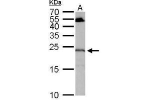 WB Image RGS4 antibody detects RGS4 protein by Western blot analysis. (RGS4 Antikörper)