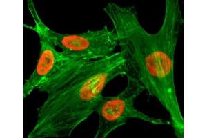 ICC/IF staining of HeLa cells treated with sodium butyrate using recombinant H2A.